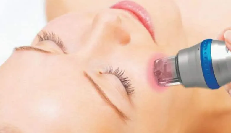 آر اف: روشی ایمن و موثر برای جوانسازی پوست