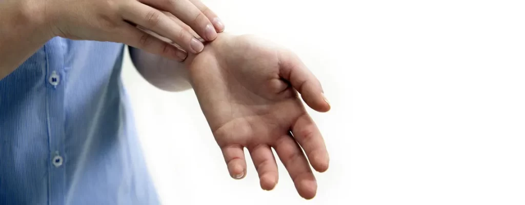 کرم الیدل؛ داروی درمان موقت اگزما