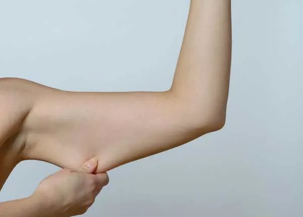 شل شدن پوست بعد از لاغری: علت و راه‌حل‌ها