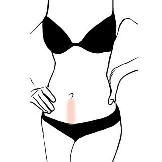 بیکینی چیست و چه انواعی دارد؟