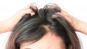 چرا پوست سر و بدنم شب‌ها می‌خارد؟