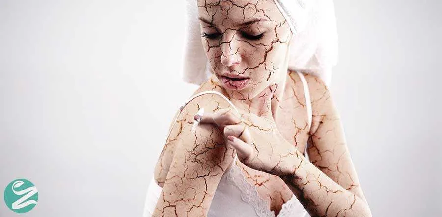 خداحافظی با خشکی پوست!