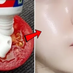 از بین بردن لک صورت با خمیردندان امکان پذیر است؟