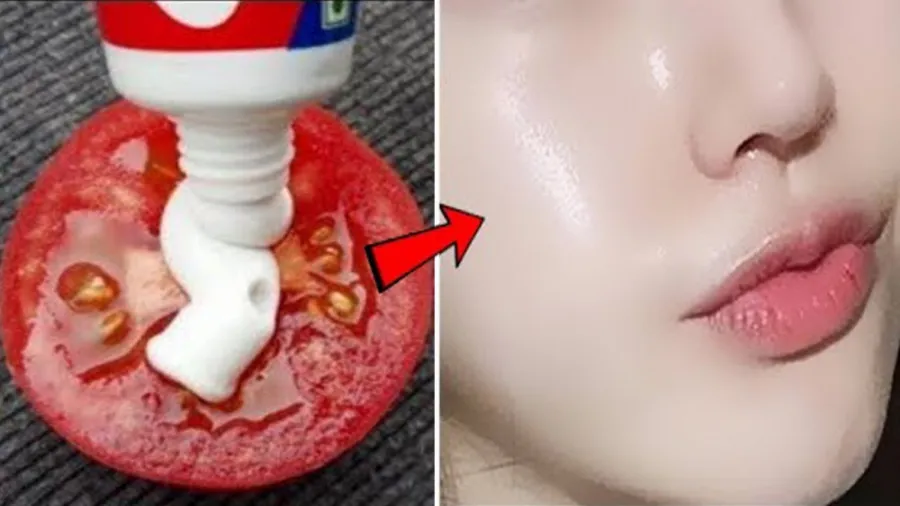 از بین بردن لک صورت با خمیردندان امکان پذیر است؟