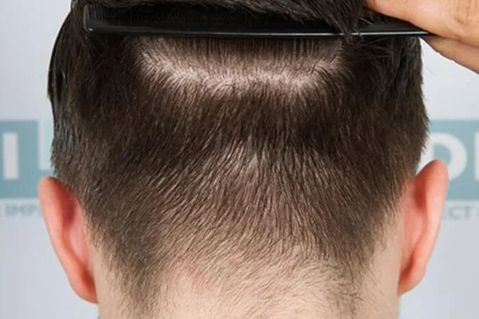 بانک مو و گرافت مو