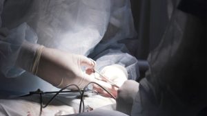 جراحی زود انزالی چقدر طول می‌کشد تا نتیجه بدهد؟