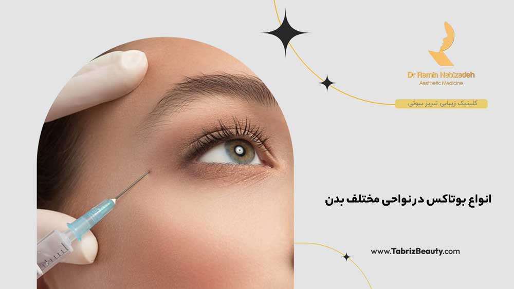 انواع بوتاکس در نواحی مختلف بدن